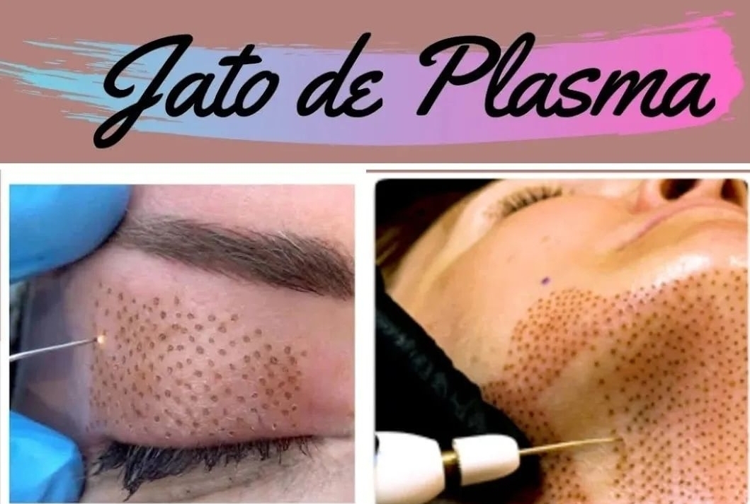 JATO DE PLASMA